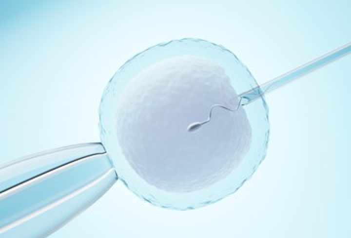 IVF